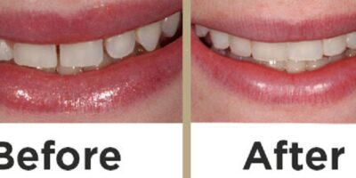 Dentist in Wakad