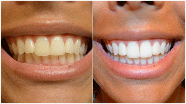 Dentist in Wakad