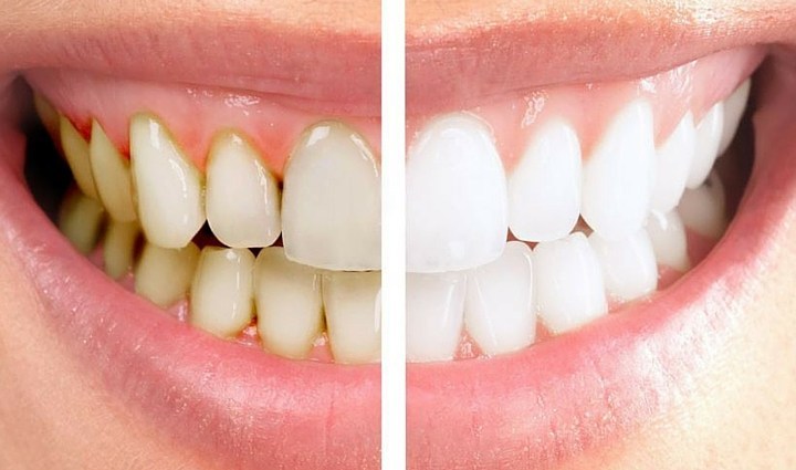 Dentist in Wakad