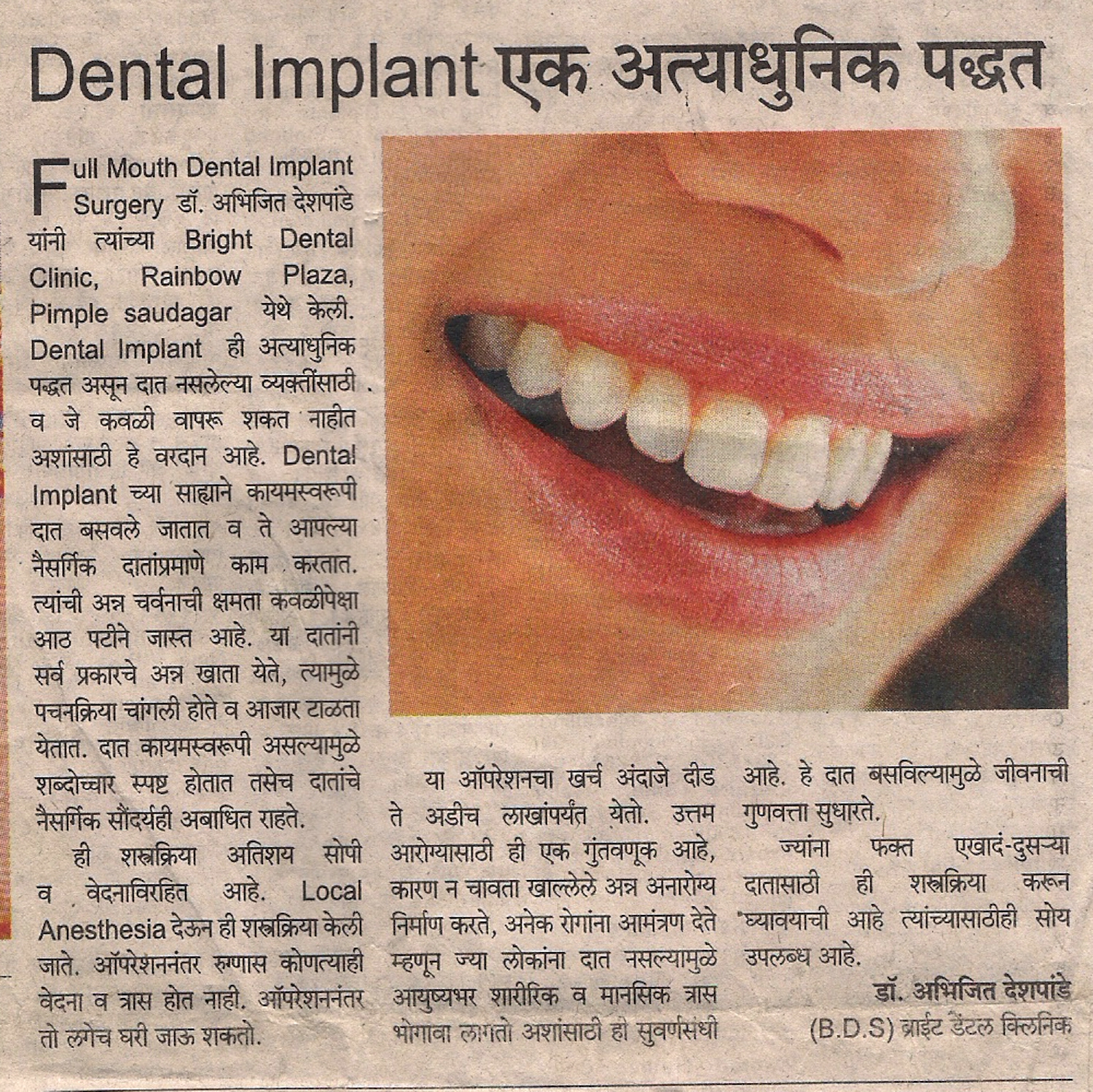 Best Dental Implant in Pimple Saudagar